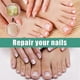 thumbnail image 4 of Nail Onycho Repair Liquid Hand And Foot Nail Soft Nail Thickening Bright Nail Nail Bump Nail Care, 4 of 5