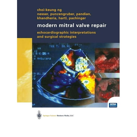 UPC: 9783709137239 | Modern Mitral Valve Repair: Echocardiographic Interpretations and Surgical Strategies (Paperback)