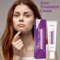 thumbnail image 2 of Crema de tratamiento para el acné, árbol de té, Control de aceite retráctil de poros, blanqueamiento, reparación de granos, Limpieza Profunda, hidratante antiacné, cuidado de la piel facial, 2 of 5