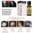 thumbnail image 2 of Aichun Hair Growth Essence 100% Plant Extract Hair Loss Scalp Treatments Ginger Genseng Raise Dense Hair Stop Liquid For Damaged Hair Enhance Your Overall Hair Condition 20ml, 2 of 9