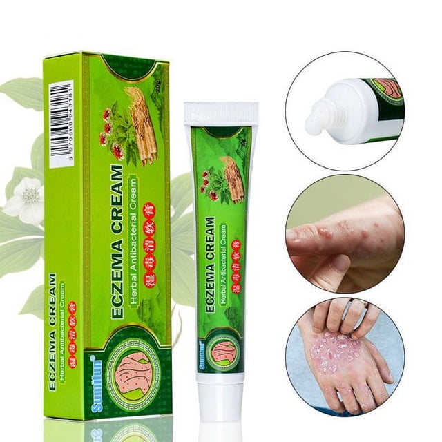 Crema Eczema, Piel Seca, Tratamiento Eczema, Crema Caléndula, Dermatitis, Manos Secas, Cutículas, Nudillos, Talones, Ungüento Caléndula