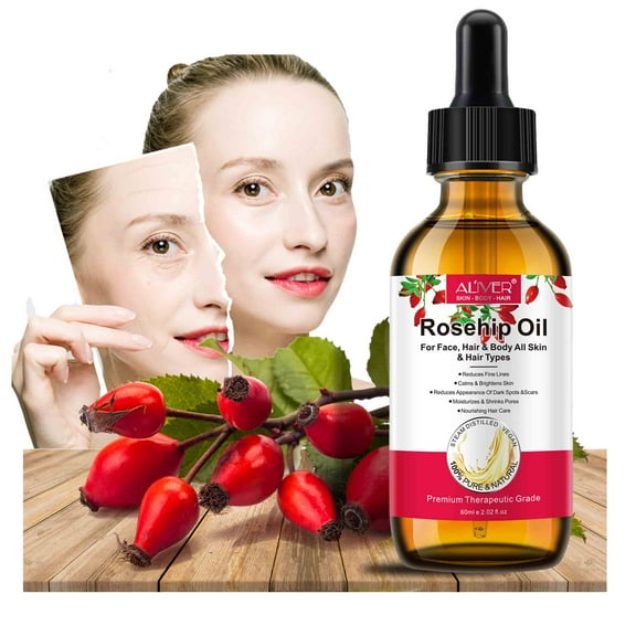 Aliver Rosehip Oil 100% Pure & Natural, Face Moisturiser and Skin Treatment, for Face & Skin - Women & Men, 2fl oz
