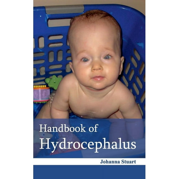 Handbook of Hydrocephalus, (Hardcover)