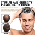 thumbnail image 3 of Shampooing Anti-Calvitie Nourrissant pour la Régénération des Cheveux pour Renforcer l'Activation des Racines des Cheveux, 3 of 5