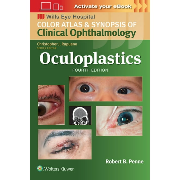 Wills Eye Institute Atlas: Oculoplastics (Paperback)