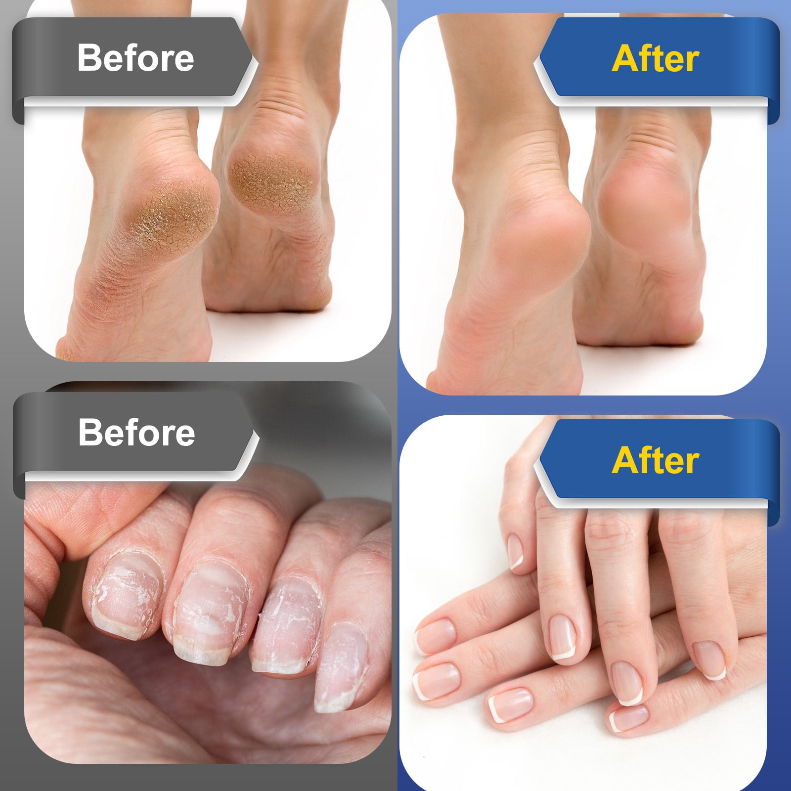 Electric Foot Callus Remover, 2 in 1 Electric Foot File Nail Grinder with Sandpaper Disk, 9 Speed, 2pcs Rotary Grinding Heads, Foot Sander Pedicure Tools for Feet Dead Skin, Black