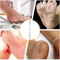 thumbnail image 4 of Lima para pies, removedor de callos, exfoliante para pies, exfoliante para ducha, removedor de piel, 4 of 5