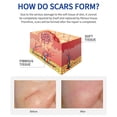 thumbnail image 4 of Scar Water Scar Liquid 30ml Scar Moisturizing Oil, 4 of 7