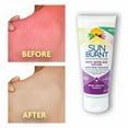 SunBurnt Advanced AfterSun Lotion, 6 oz.