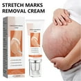 thumbnail image 3 of Stretch Mark Cream, 2Pcs 45g Scar Removal Cream Firming Skin  for Body, 3 of 8