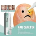 thumbnail image 3 of nail fungus remover pen for quick repair, 3 of 5