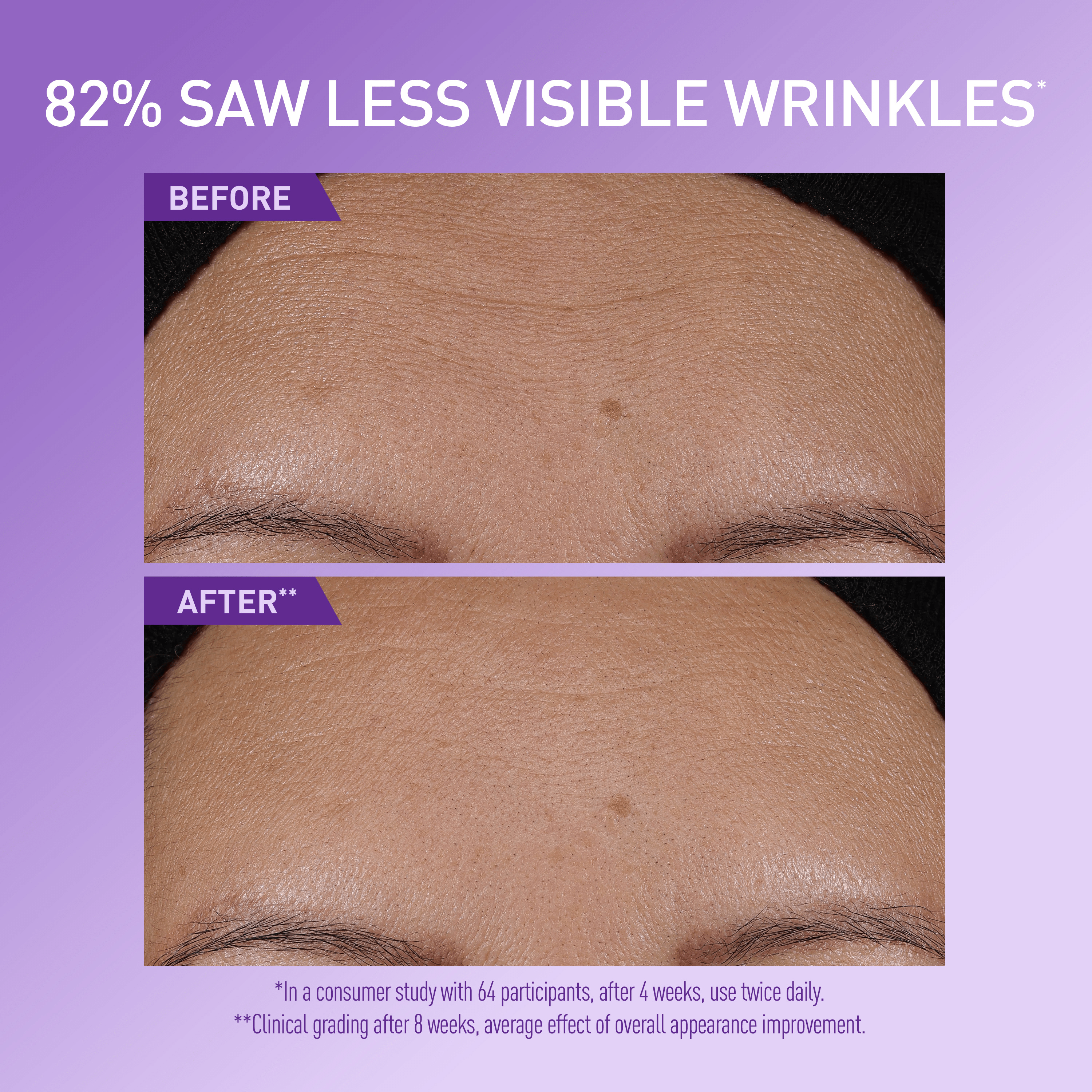 CeraVe Skin Renewing Super Boost Serum photo 4