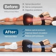 thumbnail image 3 of Memory Foam Knee Pillow Orthopaedic Leg Pillow Sleeping Orthopedic Sciatica Back Hip Joint for Pain Relief Thigh Leg Pad, 3 of 7