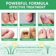 thumbnail image 3 of Nail Treatment, 7-Day Nail Fungus Treatment, Nail Repair & Strengthen Cuticles, 2.02 FL.OZ, 3 of 8