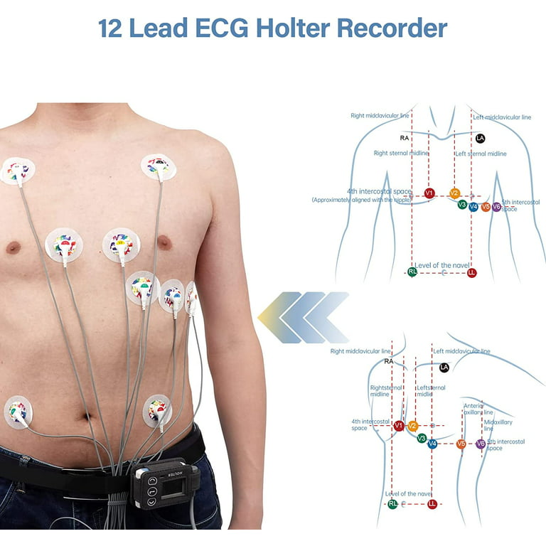 Holter ECG Device ECG 24 Hour Holter Monitor System ECG Holter - China  Portable ECG Holter, ECG Holter