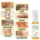 thumbnail image 3 of 3pcs 100ml Foot Peeling Spray Natural Orange Essence Pedicure Foot Hand Dead Skin Exfoliator Whiten Foot Care Spray, 3 of 5