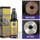 thumbnail image 3 of Stainout Boat Rust Remover, Multi-purpose Rust Inhibitor Derusting Spray, Instant Remover Car Rust Remover Spray From Chuai Du G, 3 of 5