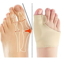 Bunion Corrector Socks 2 Pack Beige – 2025 New Orthopedic Toe Straightener for Women & Men, Comfortable Big Toe Alignment Brace, Hallux Valgus Relief Foot Pads