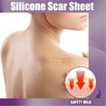 thumbnail image 3 of Scar Removal Tapes, Silicone Scar Sheets  For Burn Scars, 3 of 8