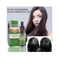 thumbnail image 1 of Aceite esencial de romero para hombres y mujeres, crecimiento del cabello, cuidado de la piel, nutrición del cuero cabelludo, 1 of 4