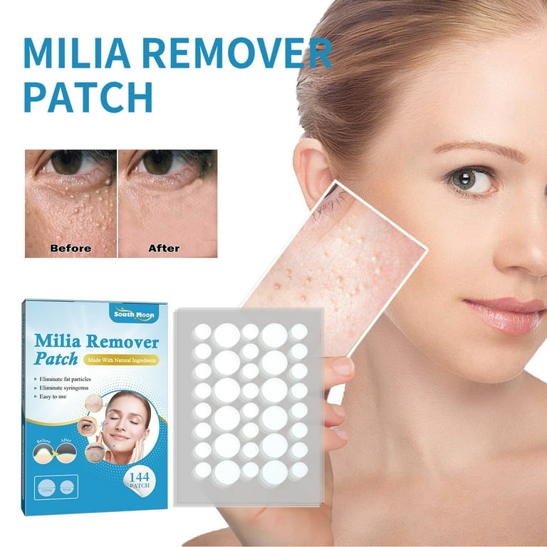 Milia Remover, 144pcs Milia Spot Treatment Patch Helps Dissolve and Reduce  Milia, Syringomas, Cysts and Sebaceous Hyperplasia 