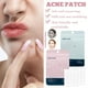 thumbnail image 3 of Facial Acne Patch Hydrocolloid Acne Patch With Tea Oil Witch Hazel Centella Asiatica And Hyaluronic, 3 of 5