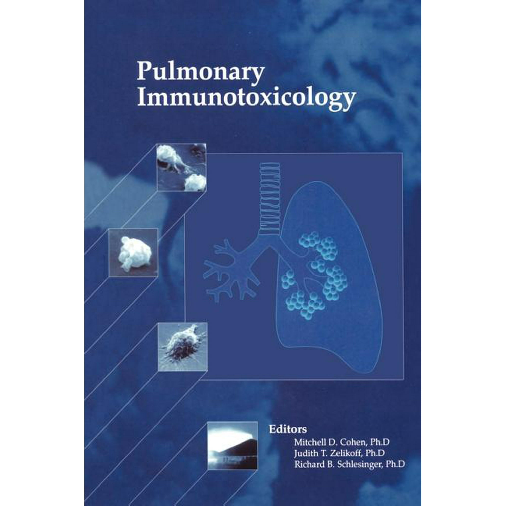 Pulmonary Immunotoxicology, (Paperback)