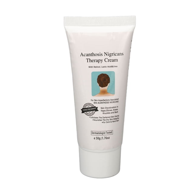 Crema correctora de manchas oscuras crema portátil de acantosis nigricans para nudillos ANGGREK Otros