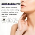 thumbnail image 3 of Soothe Skin Care Cream, Exfoliation Skin Care Cream  for Elbows, 3 of 8