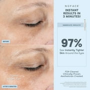 NuFACE FIX Serum, 0.5 oz