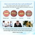 thumbnail image 4 of Teeth Whitening Gel Pen Extra Strong White Hygiene Tooth Whitener Stain Removal 5ML, 4 of 6