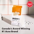 thumbnail image 2 of Hero Cosmetics Mighty Patch Nose, Hydrocolloid Nose Strips for Pores & Pimples, Absorbs Gunk and Oil, Improves the Look of Pores, 10 Count, 2 of 7