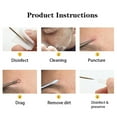 thumbnail image 5 of Trousse d'Outils pour Popper de Boutons, Outil Extracteur de Points Noirs pour le Visage, Outil Extracteur, 5 of 5