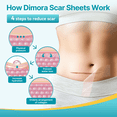 thumbnail image 4 of Dimora Silicone Scar Sheets - Medical Grade Silicone Scar Tape - Waterproof  & Hypoallergenic Scar Removal Treatment for Surgical Scars, C Section, Tummy Tuck, Burns, Keloid Treatment, 1.6”x60" Roll, 4 of 8