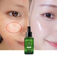 thumbnail image 2 of 17ml esencia de árbol de té, reafirmante poros contracción hidratante anti-acné esencia aceite control Yanshi Poros contracción serum, 2 of 6