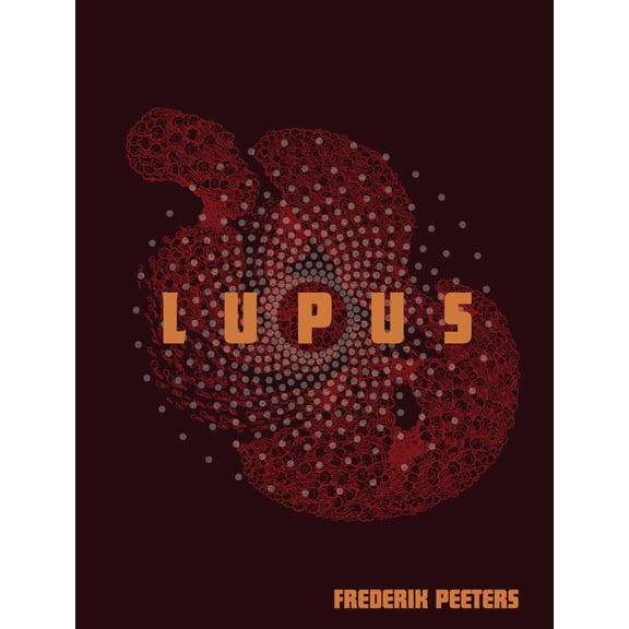 Pre-Owned Lupus (Paperback) 1603094598 9781603094597