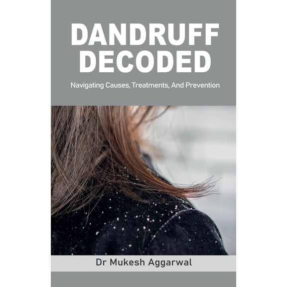 Dandruff Decoded: Navigating Causes, Treatments and Prevention, (Paperback)