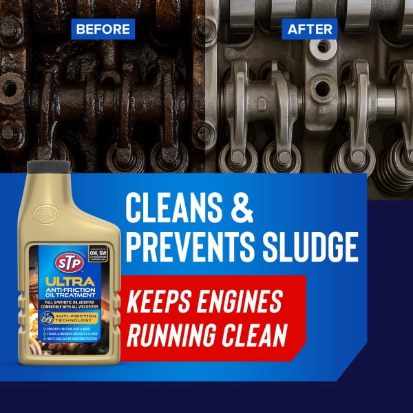 STP Ultra Anti-Friction Engine Oil Additive Treatment for Improved Performance, 15 oz