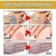 thumbnail image 5 of Bee Venom Treatment Gel For Professional Use - 1-10pcsn, 5 of 5