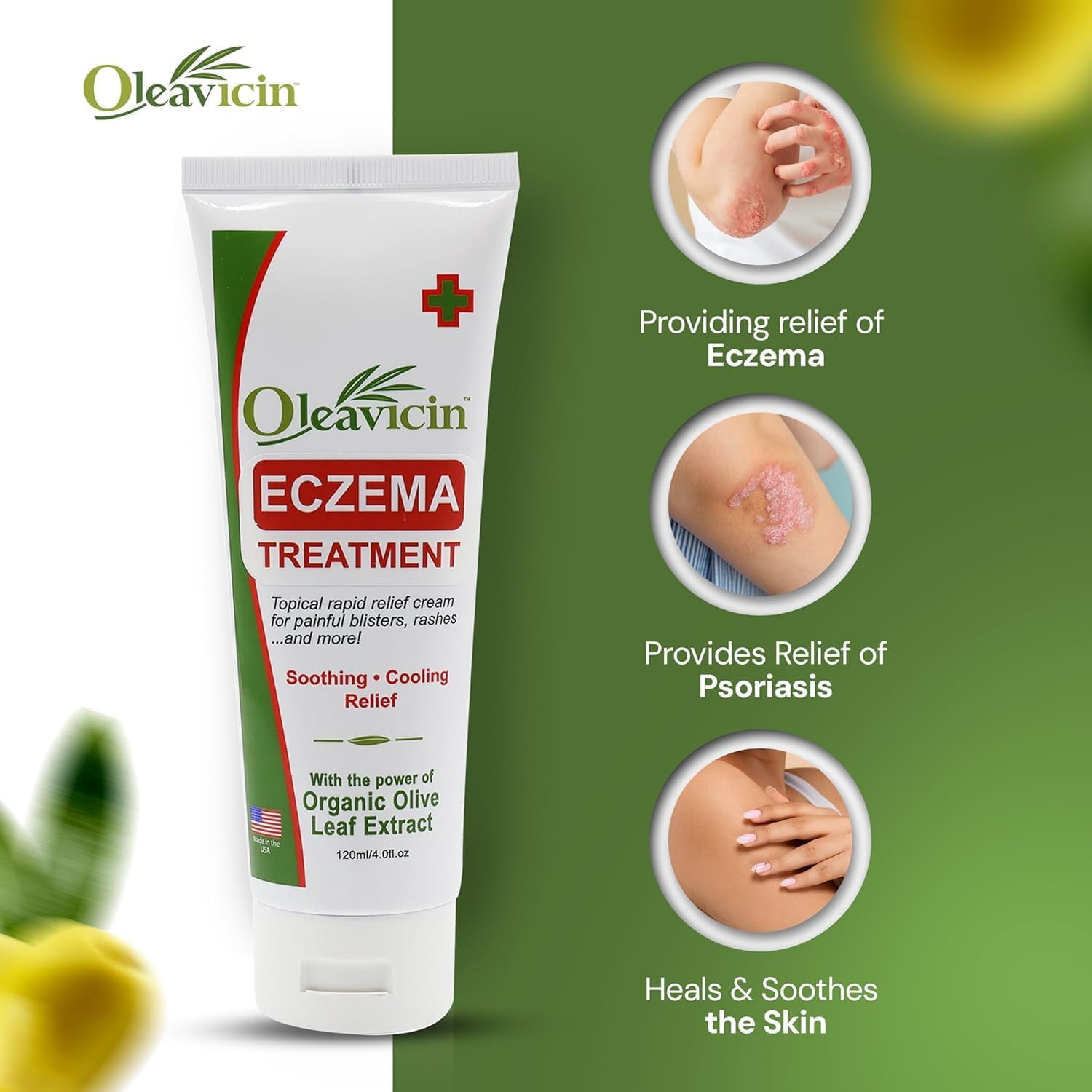 (3 pack) Oleavicin Eczema Treatment Cream, 4.0 fl oz