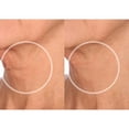 thumbnail image 3 of Parches antiarrugas SiO Beauty Facelift para rostro y cuello, 3 of 9