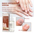 thumbnail image 3 of Suero Reparador De Uñas, Solución Para El Cuidado De Las Uñas, Refrescante Y Suave Para Las Uñas, 3 of 7