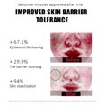 thumbnail image 5 of Crema reparadora de rojeces faciales, loción hidratante para mejorar la Rosacea Sooth, barrera de reparación de la piel sensible a la picazón, Cosméticos coreanos, nueva, 5 of 5