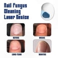 thumbnail image 4 of Laser Nail Fungus Remover Tool for Toenail and Foot Repair Treatment Kit, 4 of 5