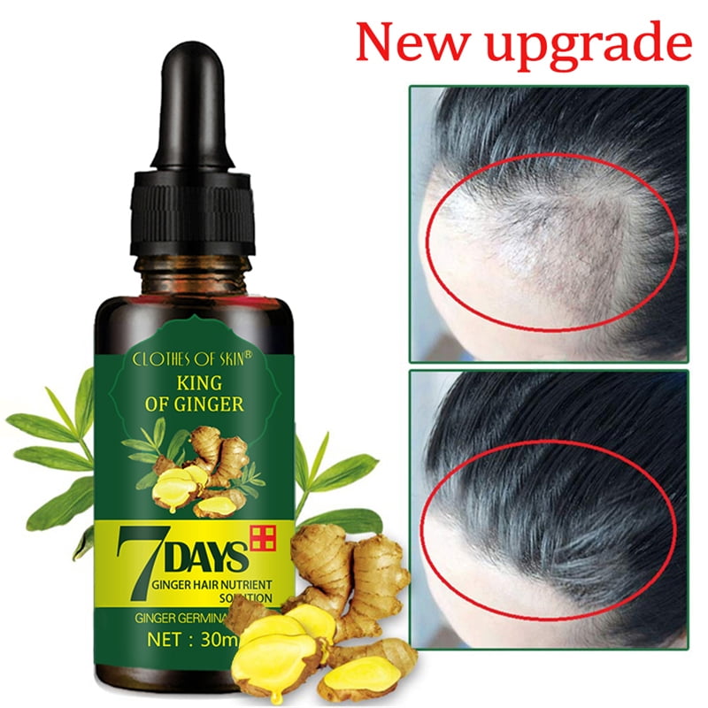 Fymall 2 Pack ReGrow Ginger Hair Growth Serum Oil Loss Treatement For