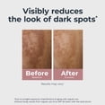 thumbnail image 5 of Eucerin Radiant Tone Dual Serum, Dark Spot Corrector with Thiamidol and Hyaluronic Acid, 1 fl oz, 5 of 15