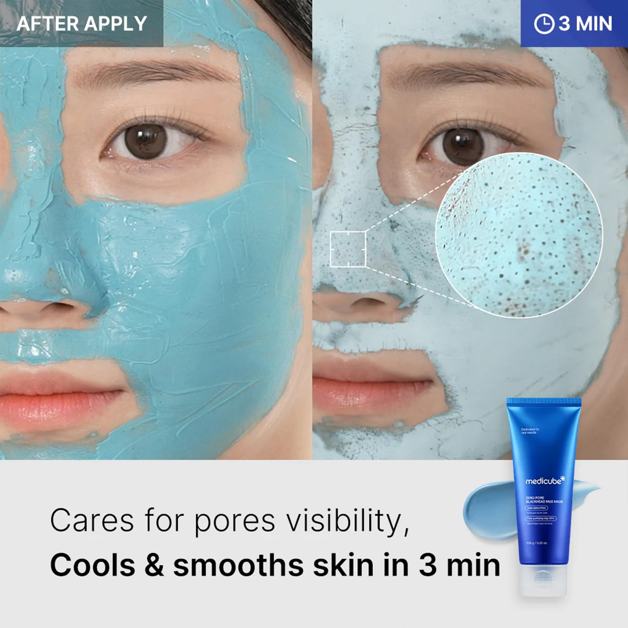 Medicube Zero Pore Blackhead Mud Mask - 3.52 oz