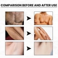 thumbnail image 3 of Hair Removal Cream for Unwanted Hair, Suitable for All Skin Types (1 Piece), 3 of 5
