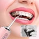 thumbnail image 2 of Oral Irrigator Dental USB Rechargeable Water Jet Floss Tooth Pick 4 Jet Tip 220ml 3 Modes Teeth Cle, 2 of 5