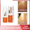 thumbnail image 4 of Suero para después del afeitado, tapón de afeitar para hombres y mujeres, removedor de depilación encarnada, Reduce el enrojecimiento de la piel, calma la solución hidratante, 4 of 5